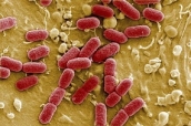 Bacterias resistentes a los antibióticos.